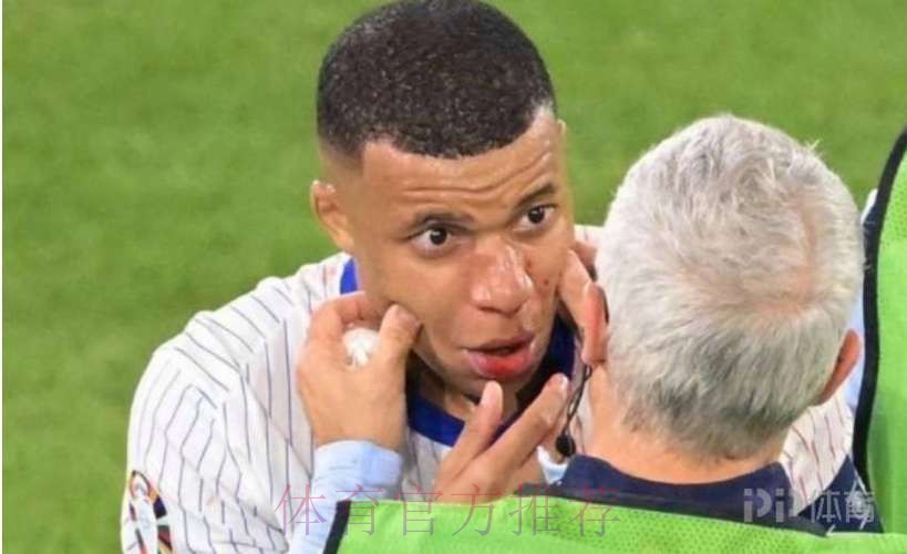 皇马担心姆巴佩鼻子骨折影响亮相 希望他接受手术 皇马担心姆巴佩鼻子骨折影响亮相 希望他接受手术